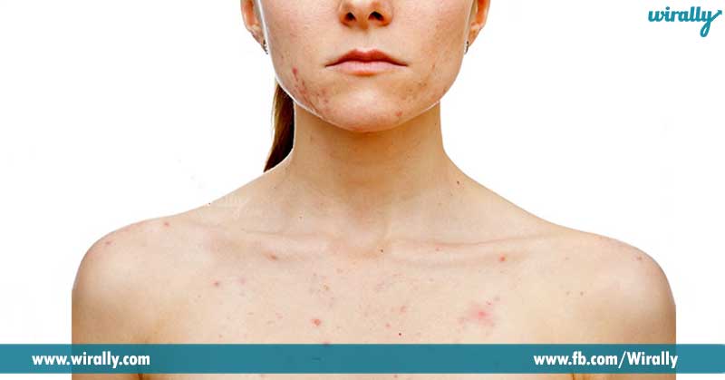9-Makes-you-get-rid-of-skin-problems