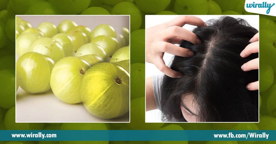 3 Benefits of Amla for our hair