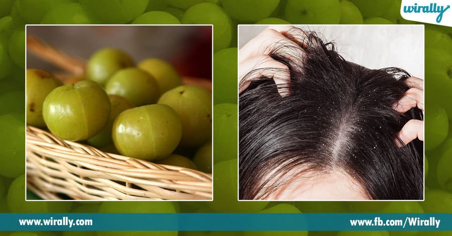 4 Benefits of Amla for our hair
