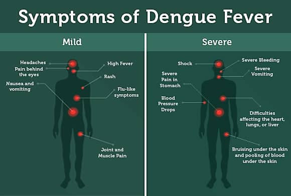 symptoms of Dengue