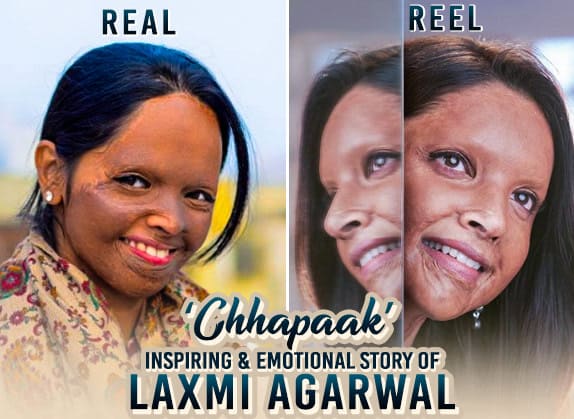 Image result for Chhapaak\ movie poster