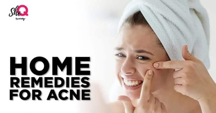 Home Remedies For Treating Acne