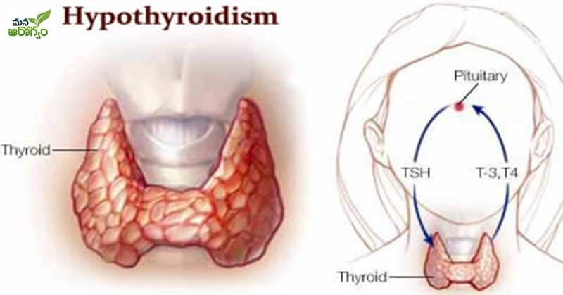 Types of thyroid, diet to take for prevention!