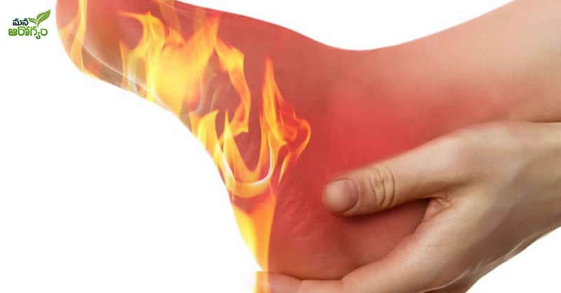 Possible causes of soles inflammation
