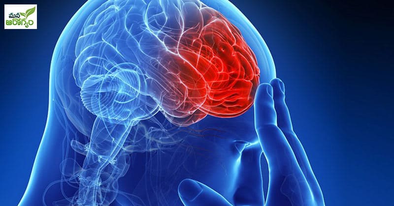 causes of brain stroke