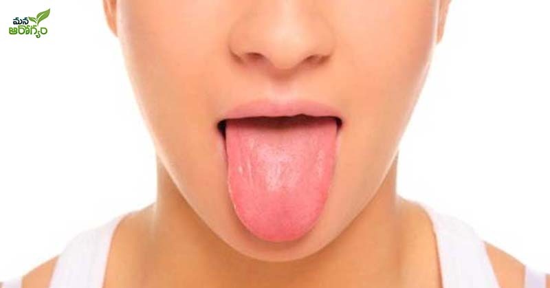 Problems That Can Occur If The Tongue Changes Colors