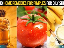 Top 10 Home Remedies for Pimples for Oily Skin