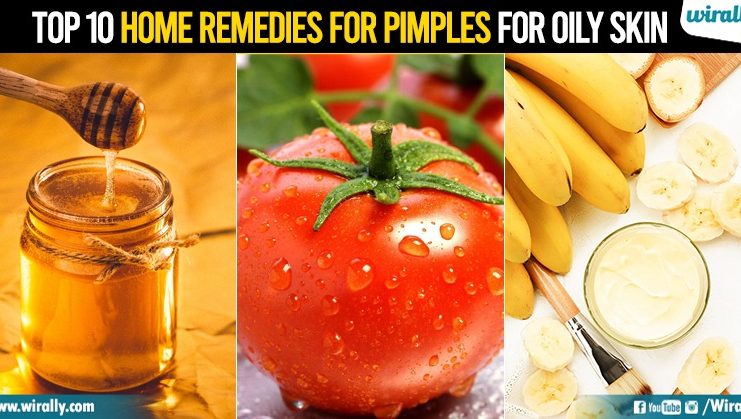 Top 10 Home Remedies for Pimples for Oily Skin